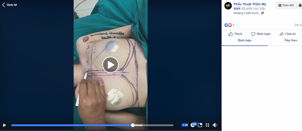 Ảnh cắt từ Livestream tạo hình phẫu thuật nâng ngực của trang “Phẫu Thuật Thẩm Mỹ A&K”