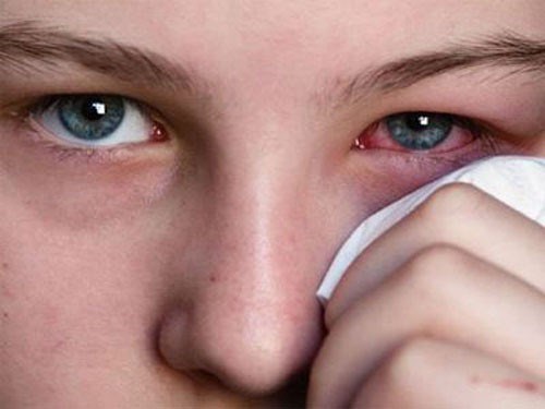 Các bệnh thường gặp sau mùa mưa lũ Các bệnh thường gặp sau mùa mưa lũ