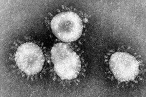 Chuyên gia: Virus gây bệnh viêm phổi lạ lây từ người sang người