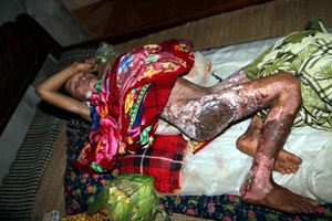 Hà Tĩnh: Điều tra nghi án cha trói, mẹ đốt con