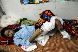 Nghi án cha trói, mẹ đốt con: Cần được hổ trợ để phải chuyển lên tuyến trên điều trị