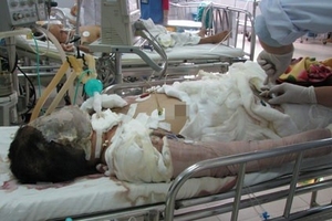 Vụ thiếu nữ bị thiêu sống ở Đà Nẵng: Đám cưới hụt và nỗi đau dang dở