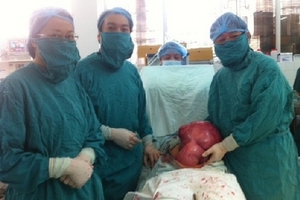 Bóc khối u xơ tử cung “siêu khủng” nặng gần… 10kg