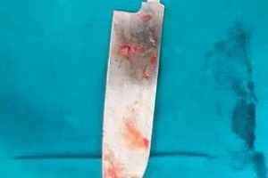 Cứu sống nữ bệnh nhân bị dao đâm sâu vào cơ thể 12 cm