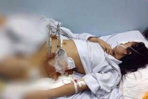 Thông tin mới vụ va chạm xe buýt, cô gái nguy kịch cần được giúp