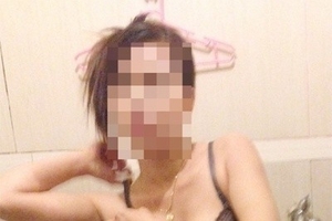 Gái mại dâm hết “đát” đi thẩm mỹ để mồi chài đại gia