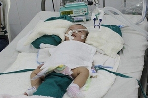 Bệnh nhi cần được giúp đỡ mổ tim