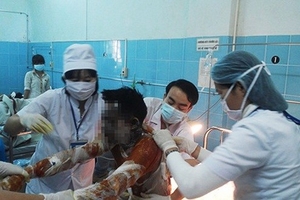 Tưới xăng lên mình và con gái châm lửa đốt, hai bố con nguy kịch