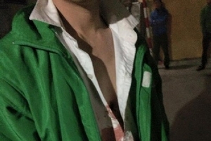 Dân tri hô, lái xe taxi Mai Linh thoát chết gang tấc trong vụ cướp