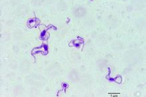 TP HCM: Ghi nhận ca nhiễm trùng roi đầu tiên tại Việt Nam