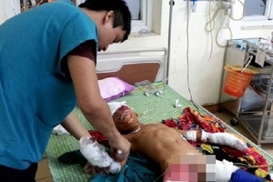 Nghệ An: Đồ chơi phát nổ, bé trai 9 tuổi bị thương nặng