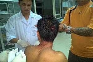 Hàng chục đối tượng cầm hung khí tấn công thanh niên tại quán bia