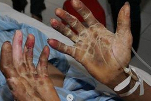 Tác hại của tiết canh!