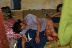 Giám đốc Công ty Thái An chỉ huy côn đồ truy sát 3 công nhân