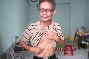 Khởi tố nghịch tử sát hại cha ruột