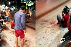 Bị chém đứt lìa tay sau cuộc truy sát trong đêm