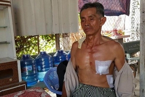 Lái xe ôm giả chết, sống sót sau nhát dao của hai tên cướp