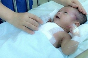 Phẫu thuật cứu sống bệnh nhi 1,5 tháng tuổi mắc 4 dị tật tim bẩm sinh hiếm gặp