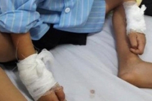 Nghệ An: Bác sỹ bị đình chỉ chuyên môn 1 tháng vì mổ nhầm tay trẻ 6 tuổi