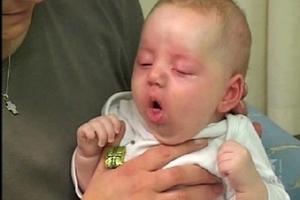 Phát hiện hơn 150 trường hợp viêm đường hô hấp cấp tính nghi ho gà