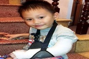 Sẽ xử lý kỷ luật 4 bác sĩ chẩn đoán nhầm bệnh nhi gãy tay