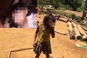 Đắk Lắk: Thêm 2 bé bị đầu nhỏ, nghi mắc vi rút Zika