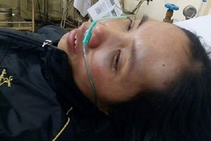 Một thầy giáo đánh phụ nữ chấn thương sọ não