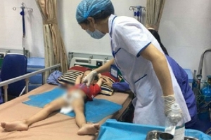 Hưng Yên: Gần 40 bé trai bị mắc sùi mào gà sau khi cắt bao quy đầu