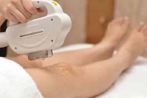 Chị em rước nguy cơ hỏng da từ công nghệ triệt lông laser “thần thánh”