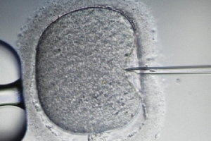 Lần đầu tiên trên thế giới điều trị vô sinh thành công bằng phương pháp “3 bố mẹ