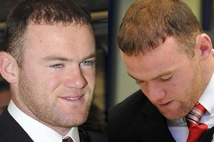 Đã đến lúc Rooney đòi lại tiền cấy tóc?