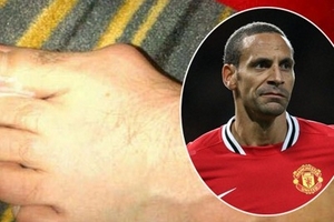 Rio Ferdinand mắc căn bệnh bí ẩn?