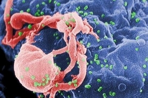 Tạo ra tế bào có thể tiêu diệt virút HIV