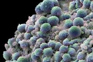 Nhật phát hiện chất điều tiết tốc độ di căn ung thư