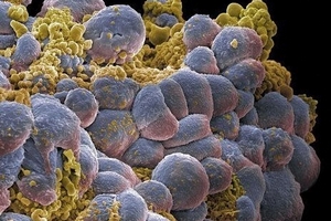 Phát triển loại thuốc tiêu diệt nhiều loại ung thư