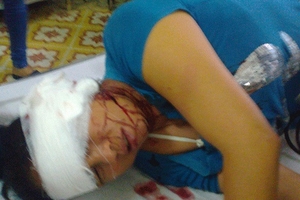 Xông vào nhà chém đứt tai một phụ nữ