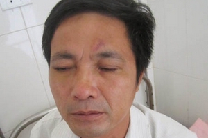 Thanh Hóa: Cán bộ phường đánh bạc và đánh nhau túi bụi