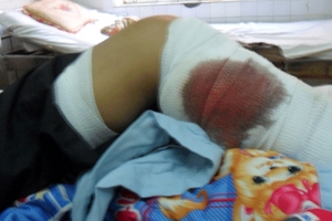 Chi cục phó thi hành án bị côn đồ chém trước nhà