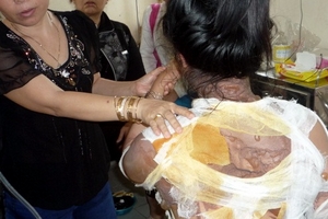 Chưa ngăn chặn người chồng tạt nước sôi vợ