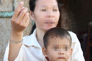 Vụ bé trai bị rạch nát mặt: 2 tháng tuổi đã bị châm nhang vào mặt, cổ