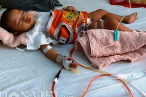 Cắt nhầm bàng quang bệnh nhi 21 tháng tuổi