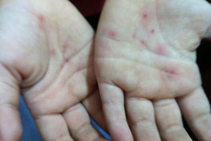 Hà Nội: 2 trẻ mẫu giáo “bị thương” trong giờ học