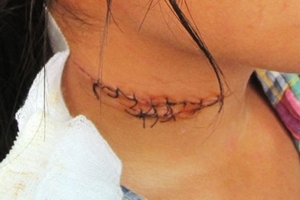 U mê tà đạo, ép con tự tử vì muốn được "lên tiên"