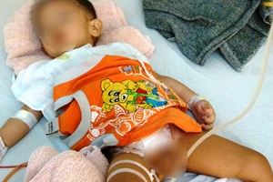 Vụ cắt nhầm bàng quang bé 21 tháng: Sở Y tế báo cáo UBND tỉnh