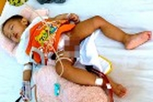 Bác sĩ nước ngoài sẽ điều trị vụ cắt nhầm bàng quang