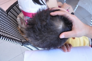 Một bé mẫu giáo “tố” bị cô giáo đánh vào đầu