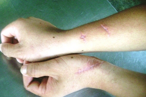 Khỉ lạ tấn công nhiều đàn ông