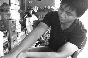 Khỉ cụt chân tấn công người rồi... biến mất