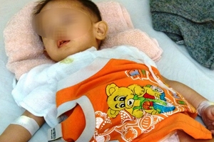 Hội chẩn vụ cắt nhầm bàng quang