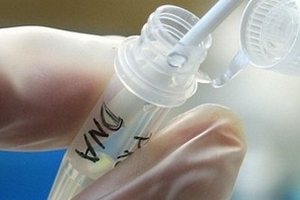 Phát hiện ưu thế của xét nghiệm ADN từ nước bọt